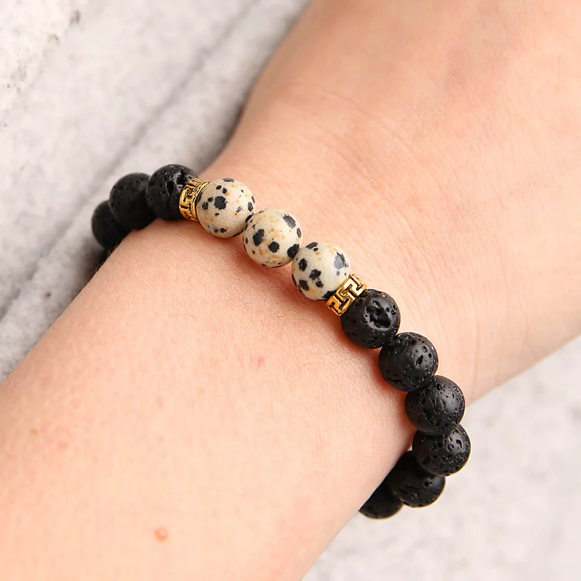 Dalmatian Diffuser Bracelet - Image 5